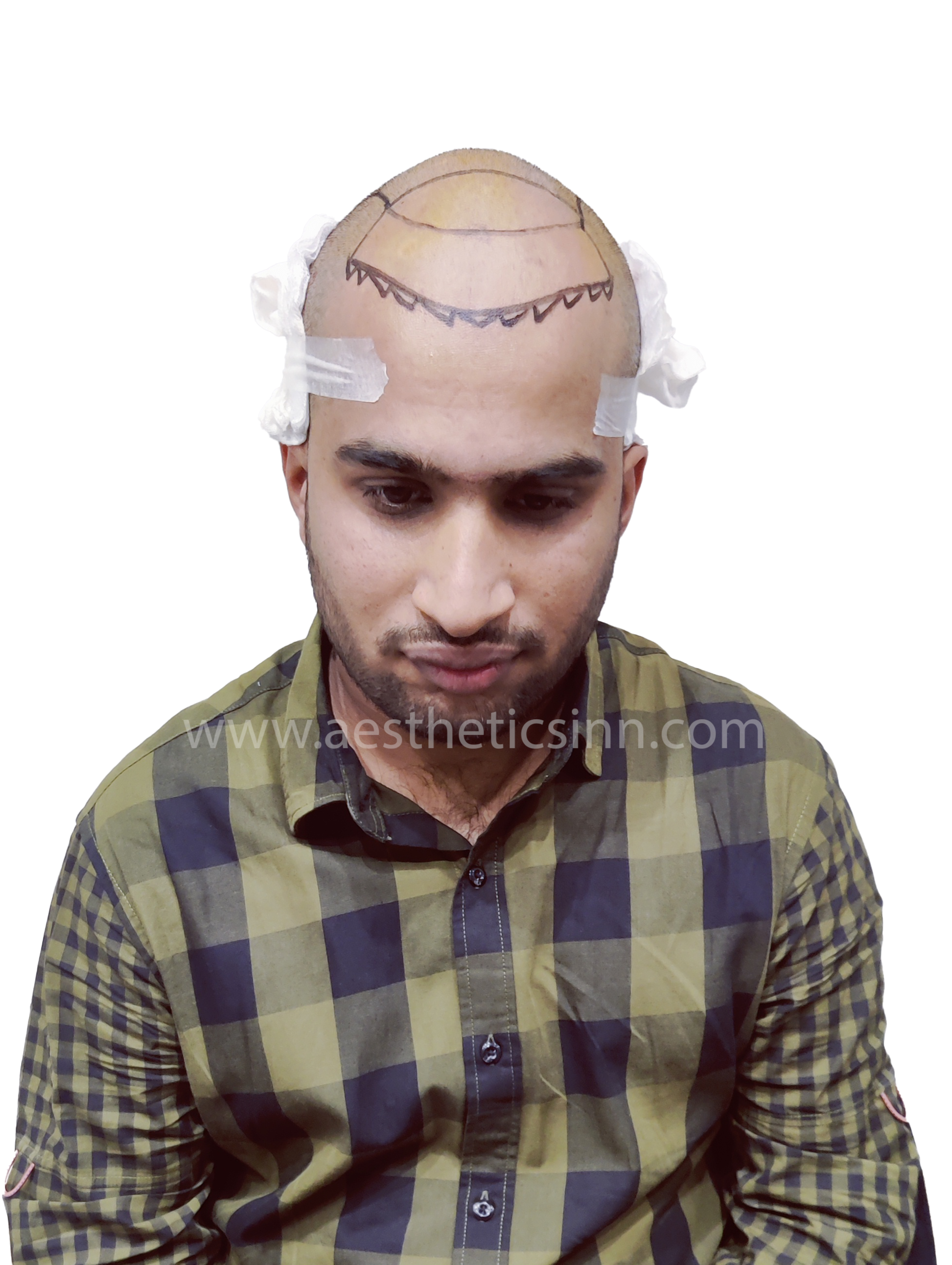 Abuzar Abid Surgical Blueprint