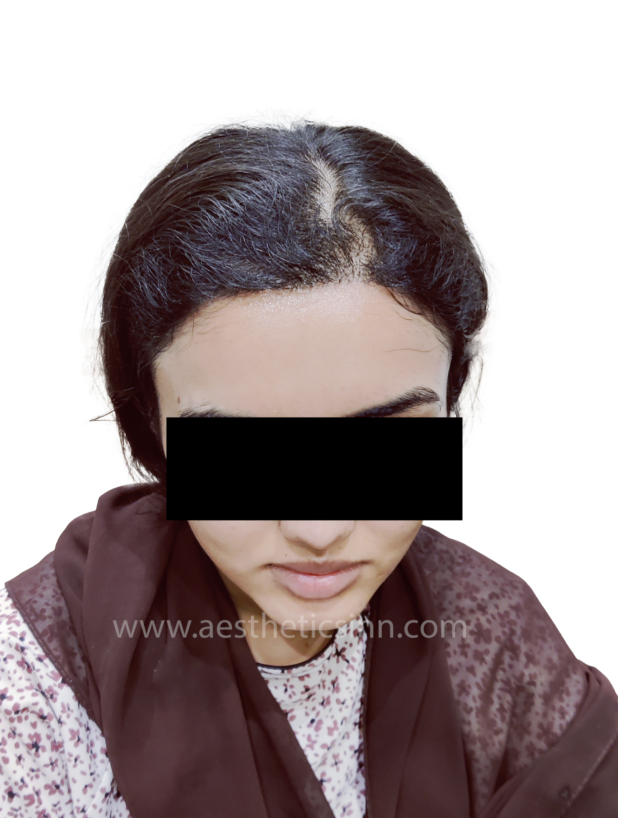 Aqsa Hameed Matured 12-Month Result