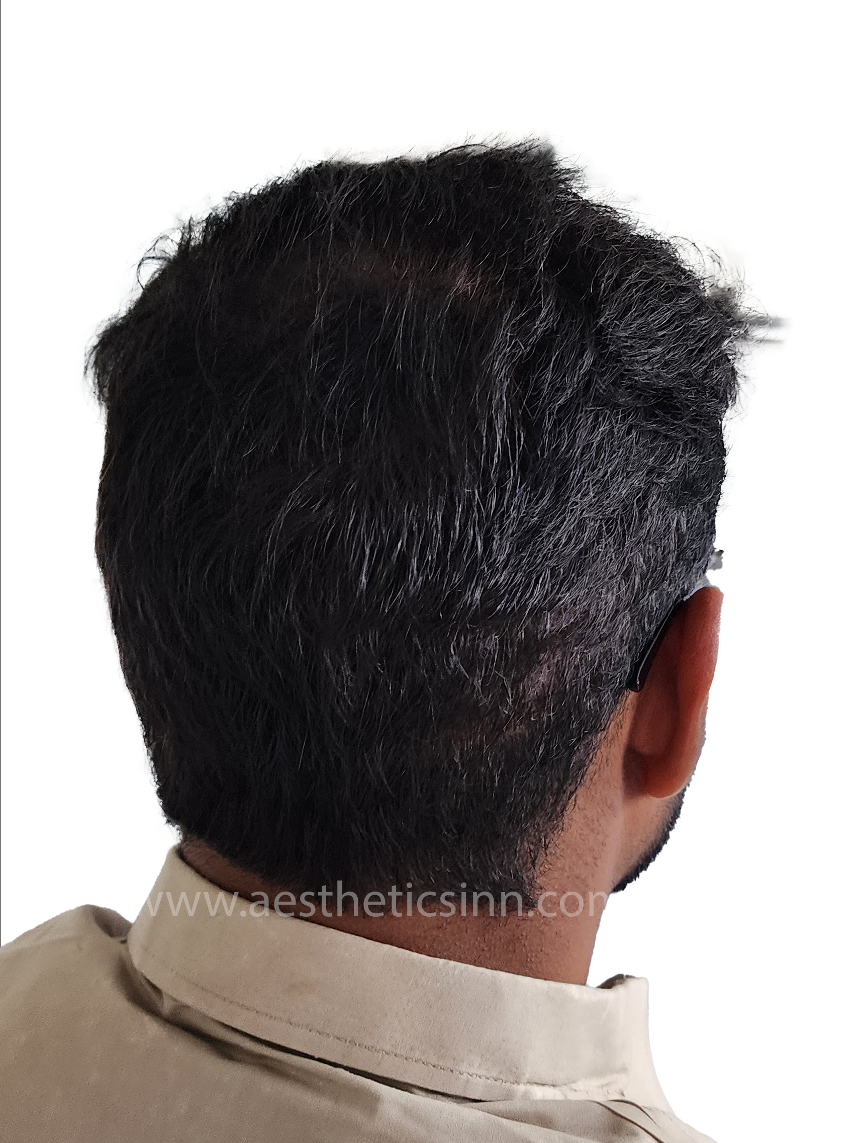 Azfar Javed Crown View After