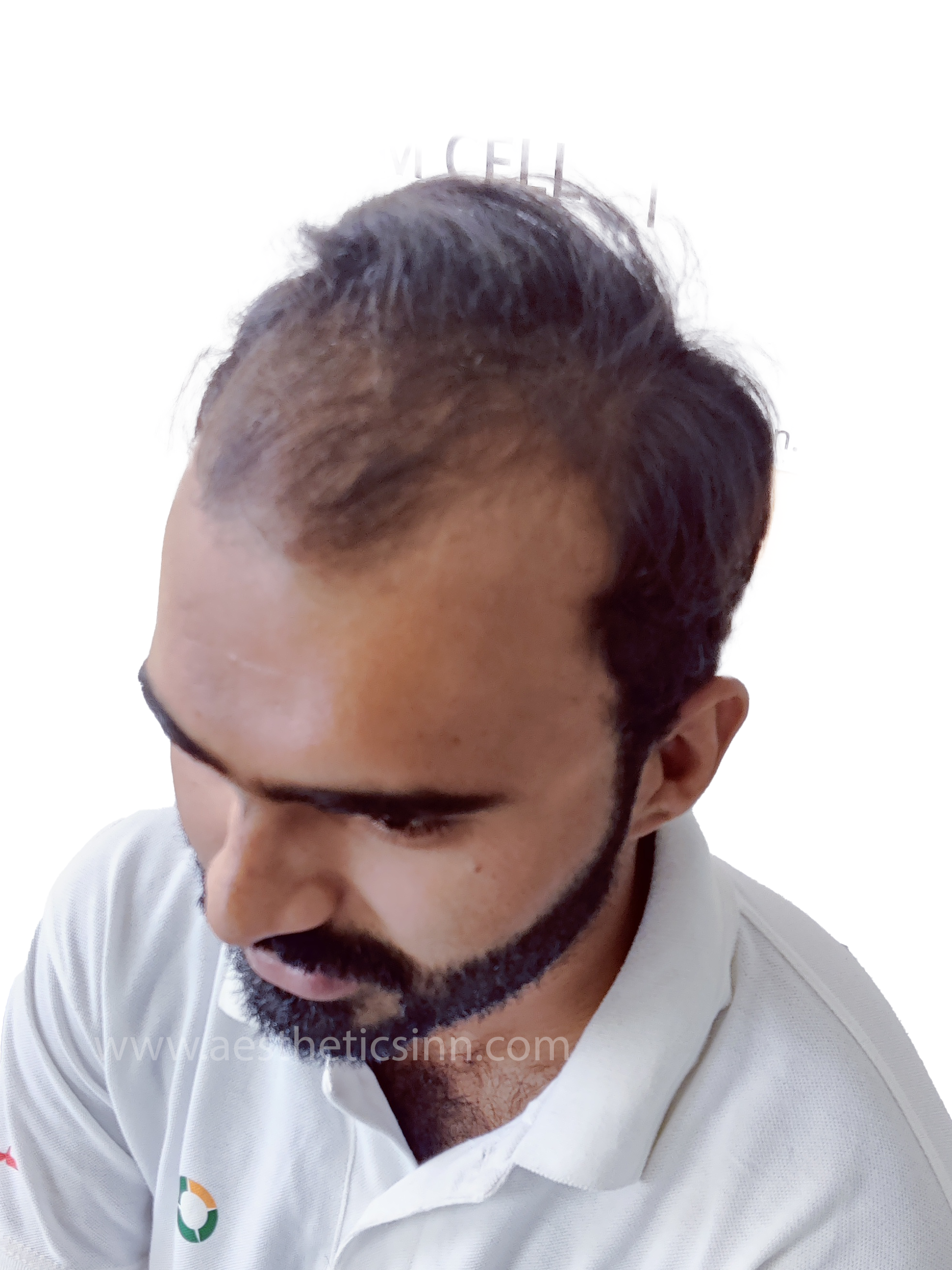 Azfar Javed Left Temple Before
