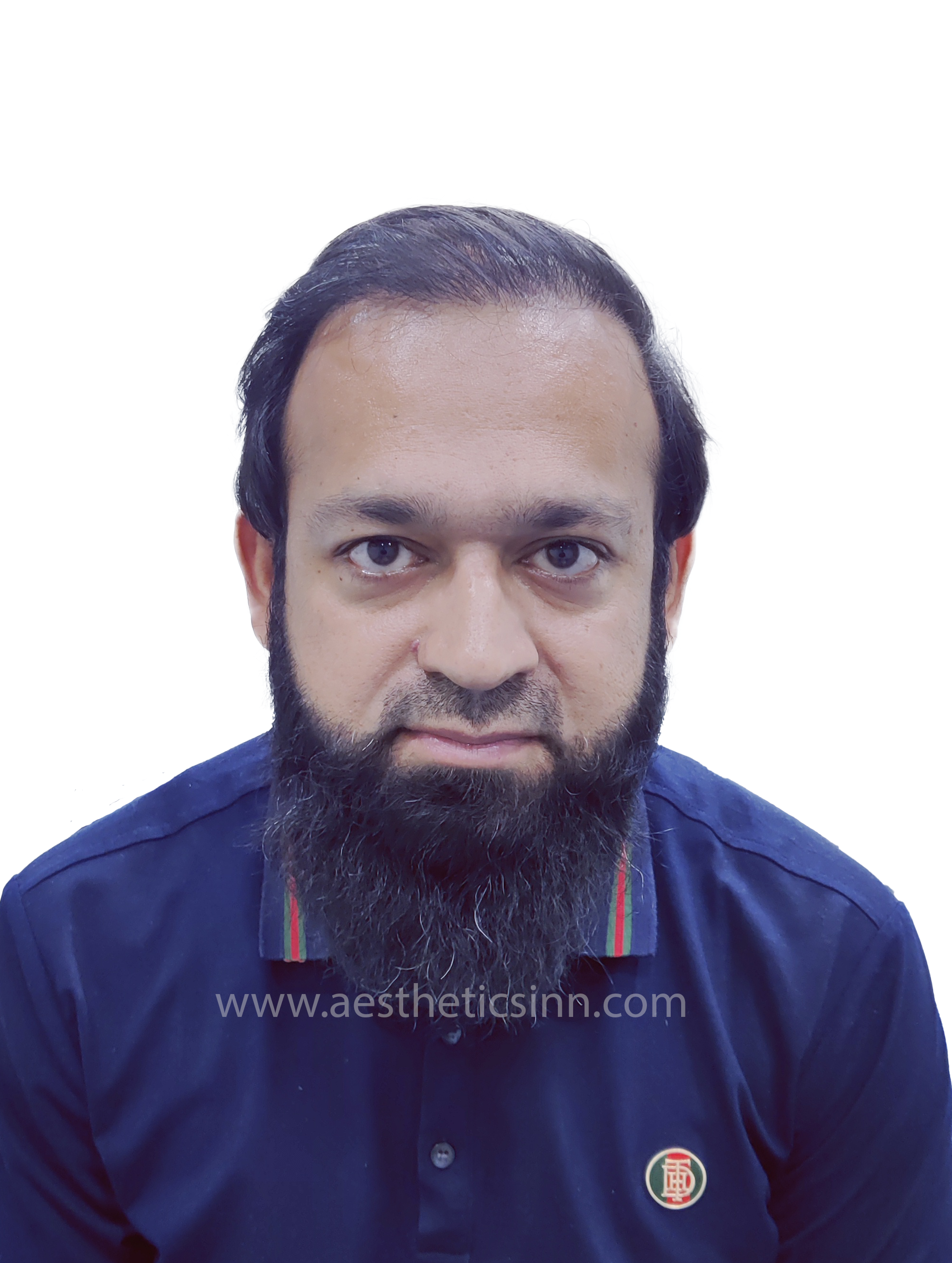 After Hair Transplant - Dr. Salman