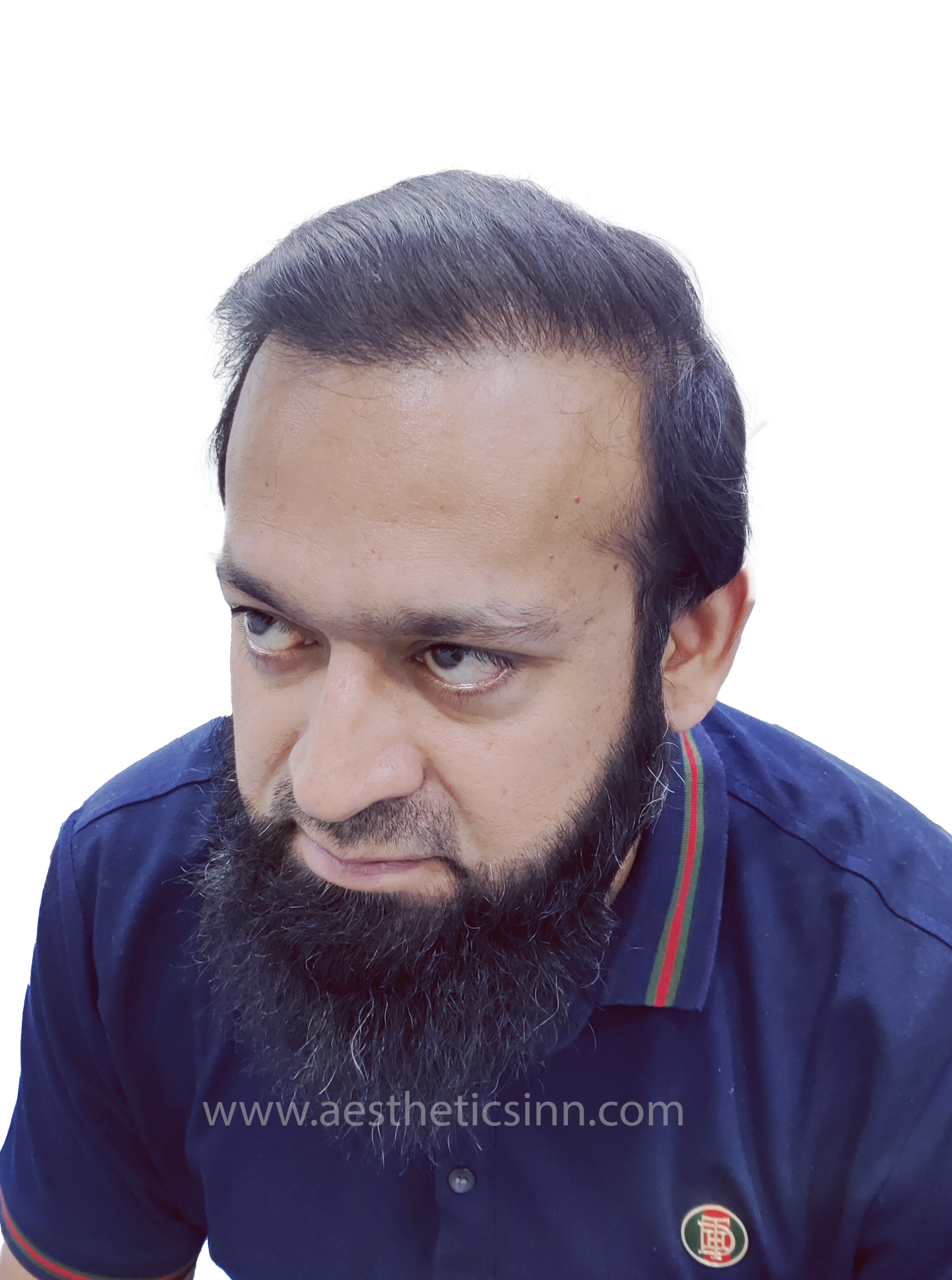 Dr. Salman Left Temple After
