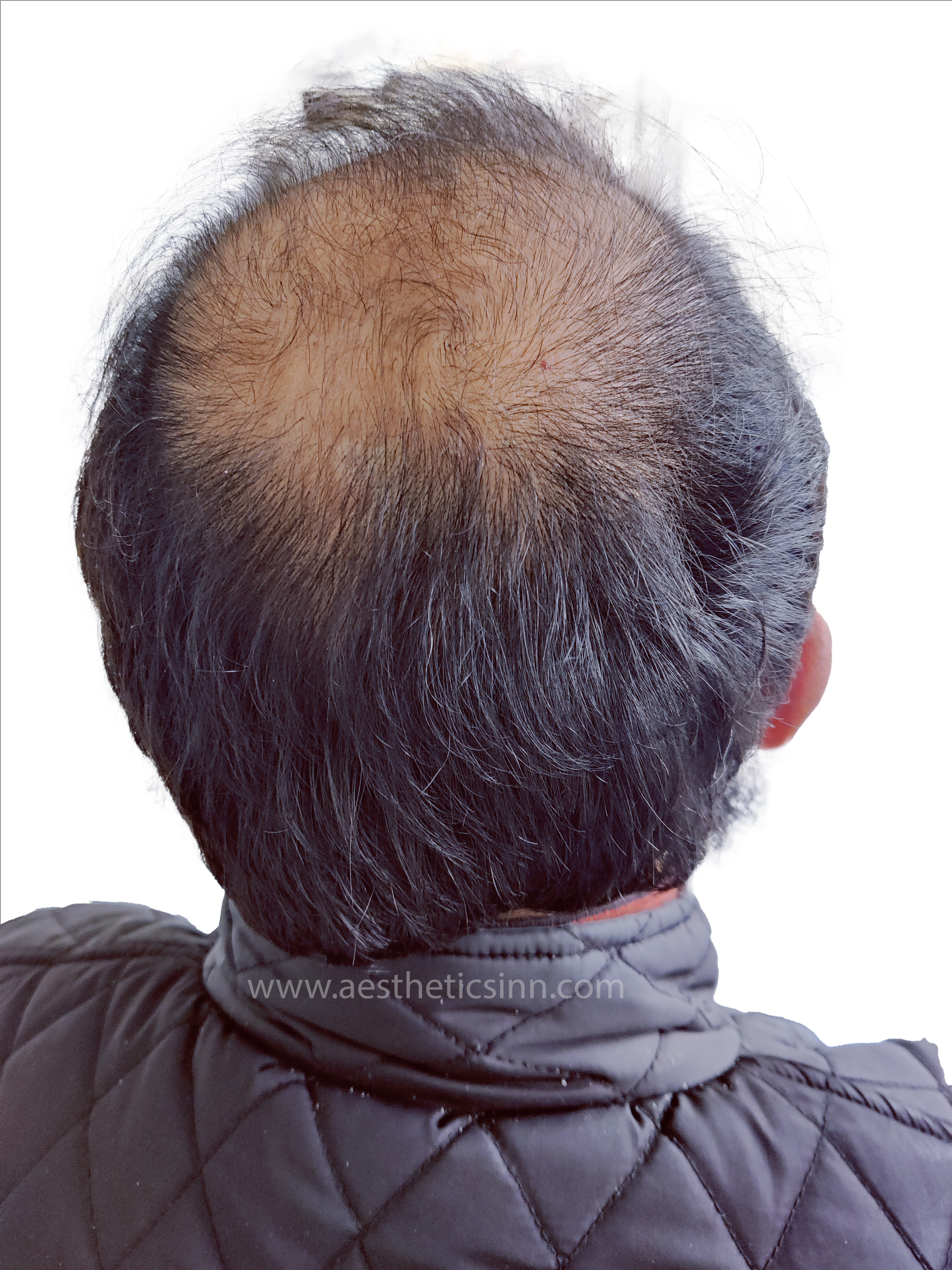 Dr. Salman Top View Before