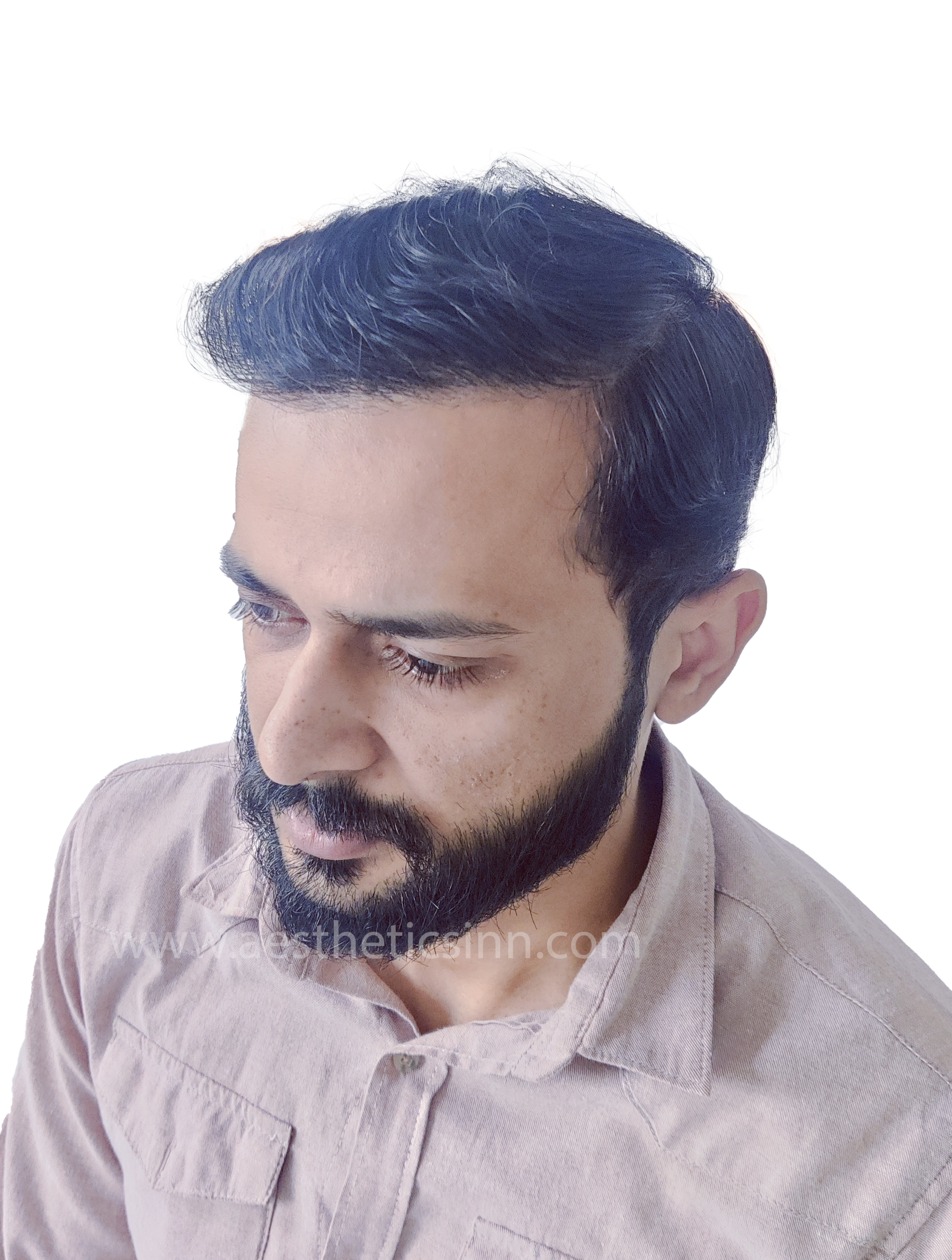 Ibrar Shami Right Profile After