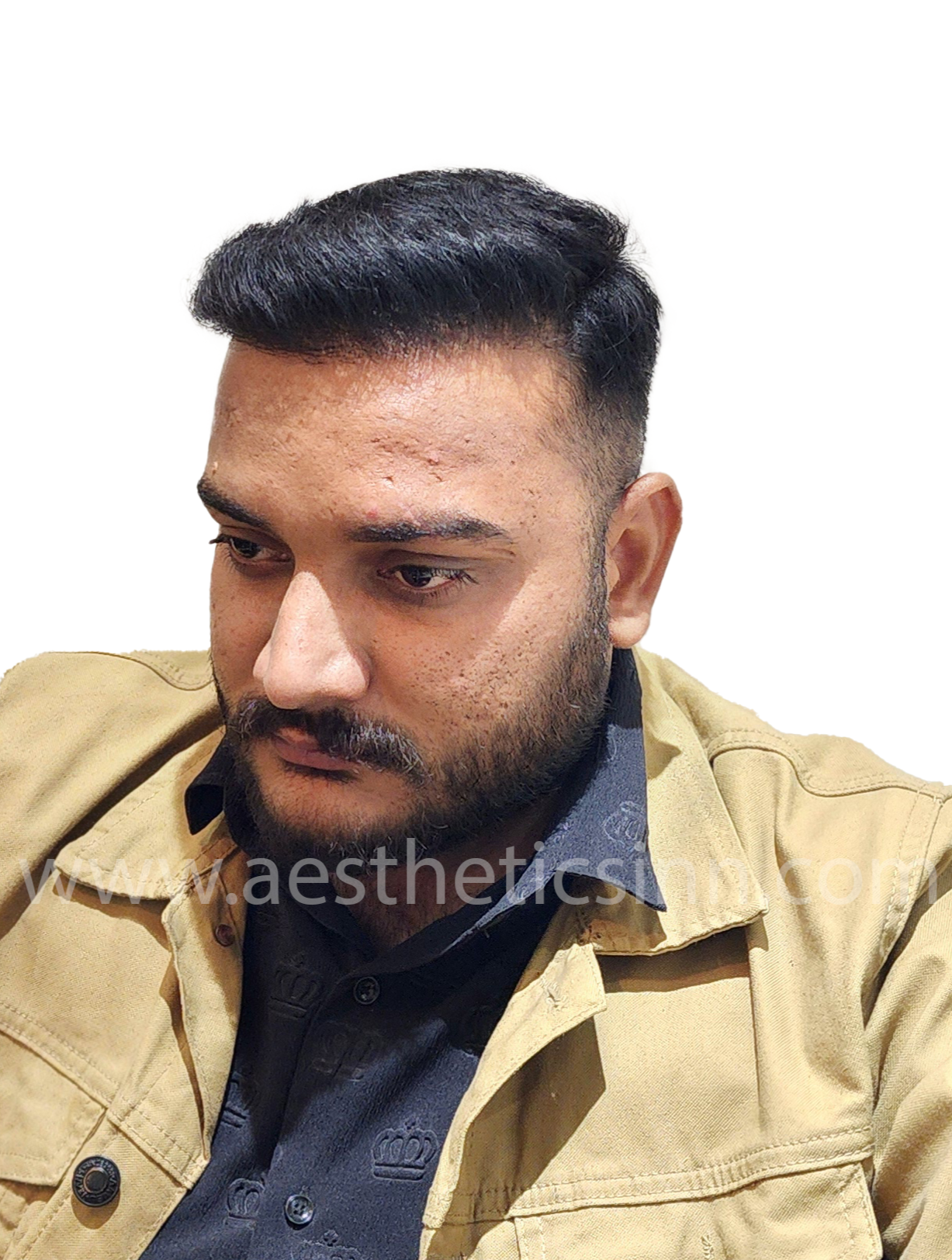 Shahryar Liaqat Right Profile After