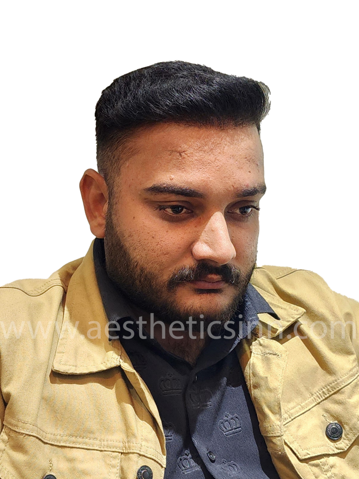 Shahryar Liaqat Left Profile After