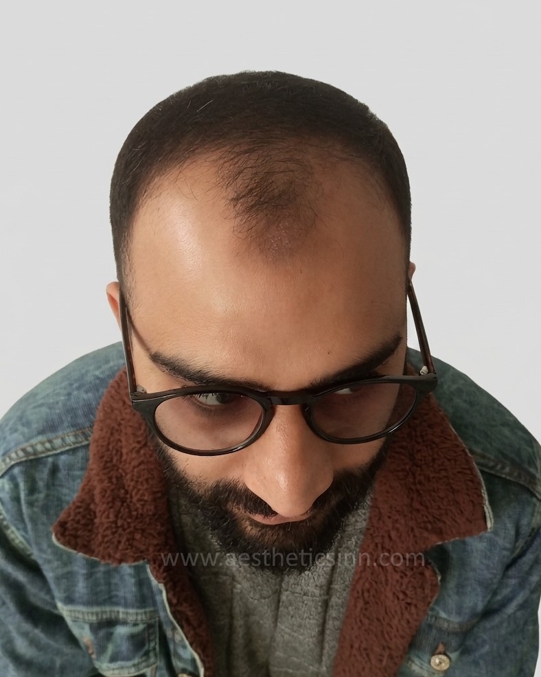 Afan Mushtaq Top View Before
