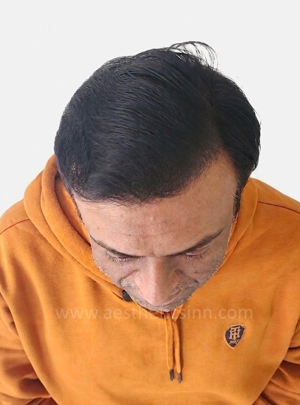 Faisal Adrees Top View After