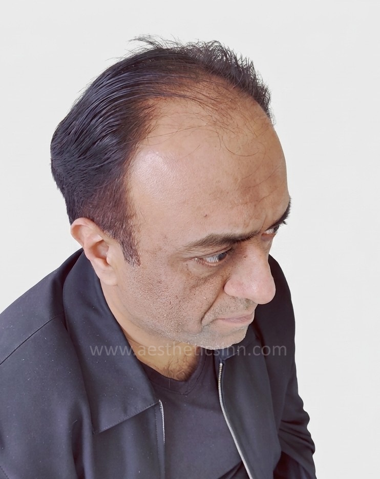 Faisal Adrees Left Temple Before