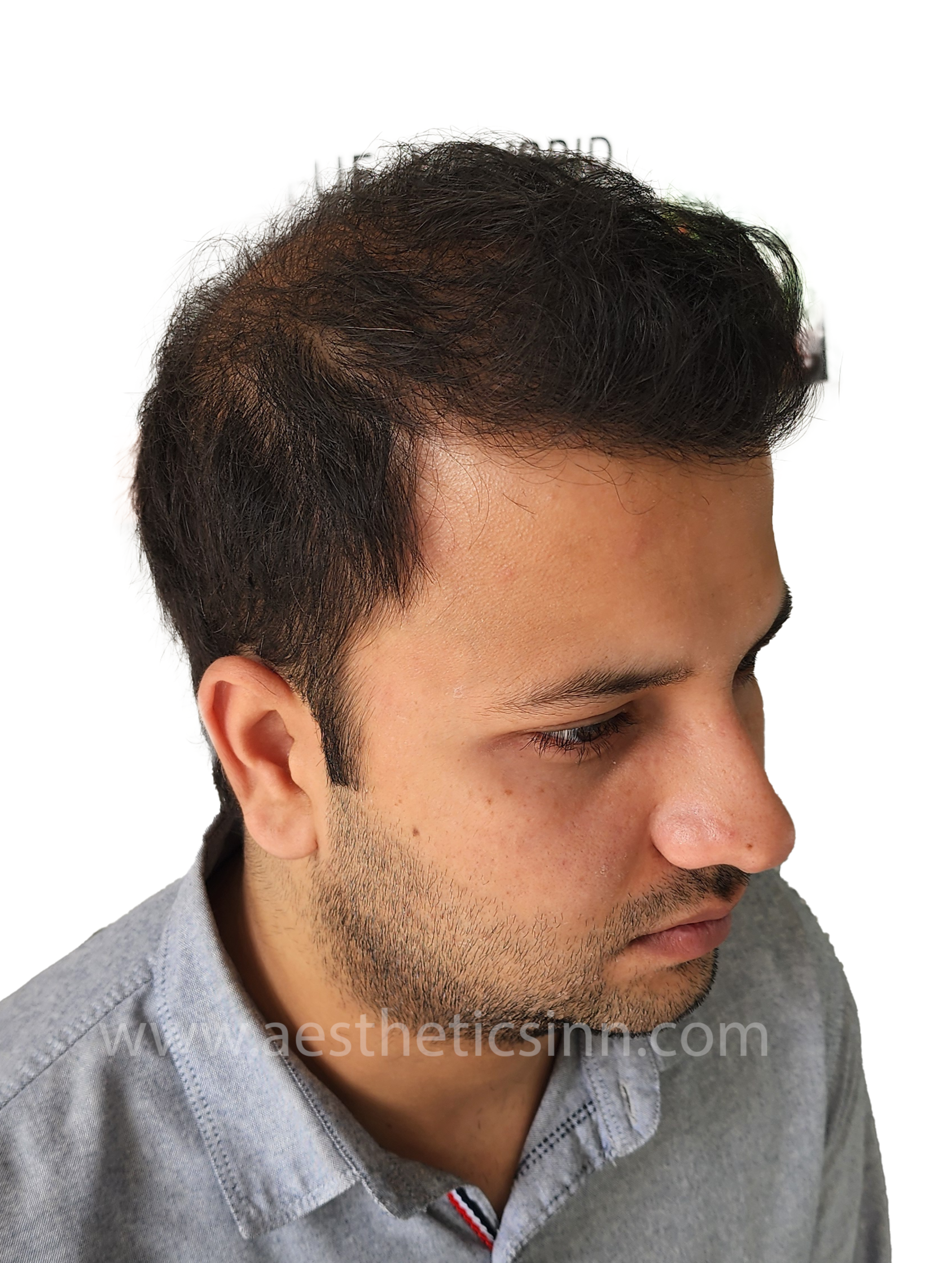 Hamza Kahloon Left Profile After