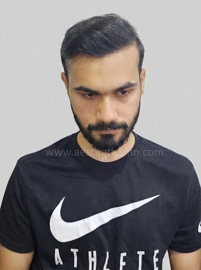 Moiz Arshad Top View After