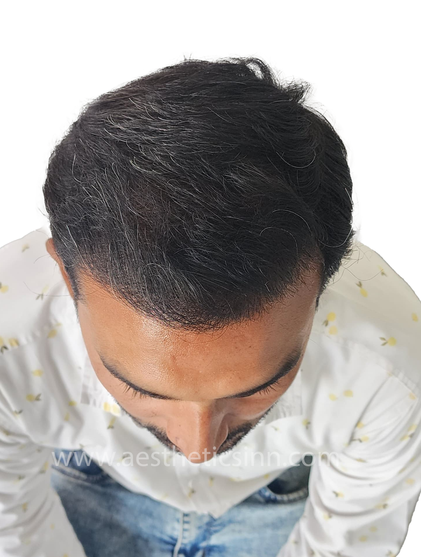 Mujahid Azeem Top View After