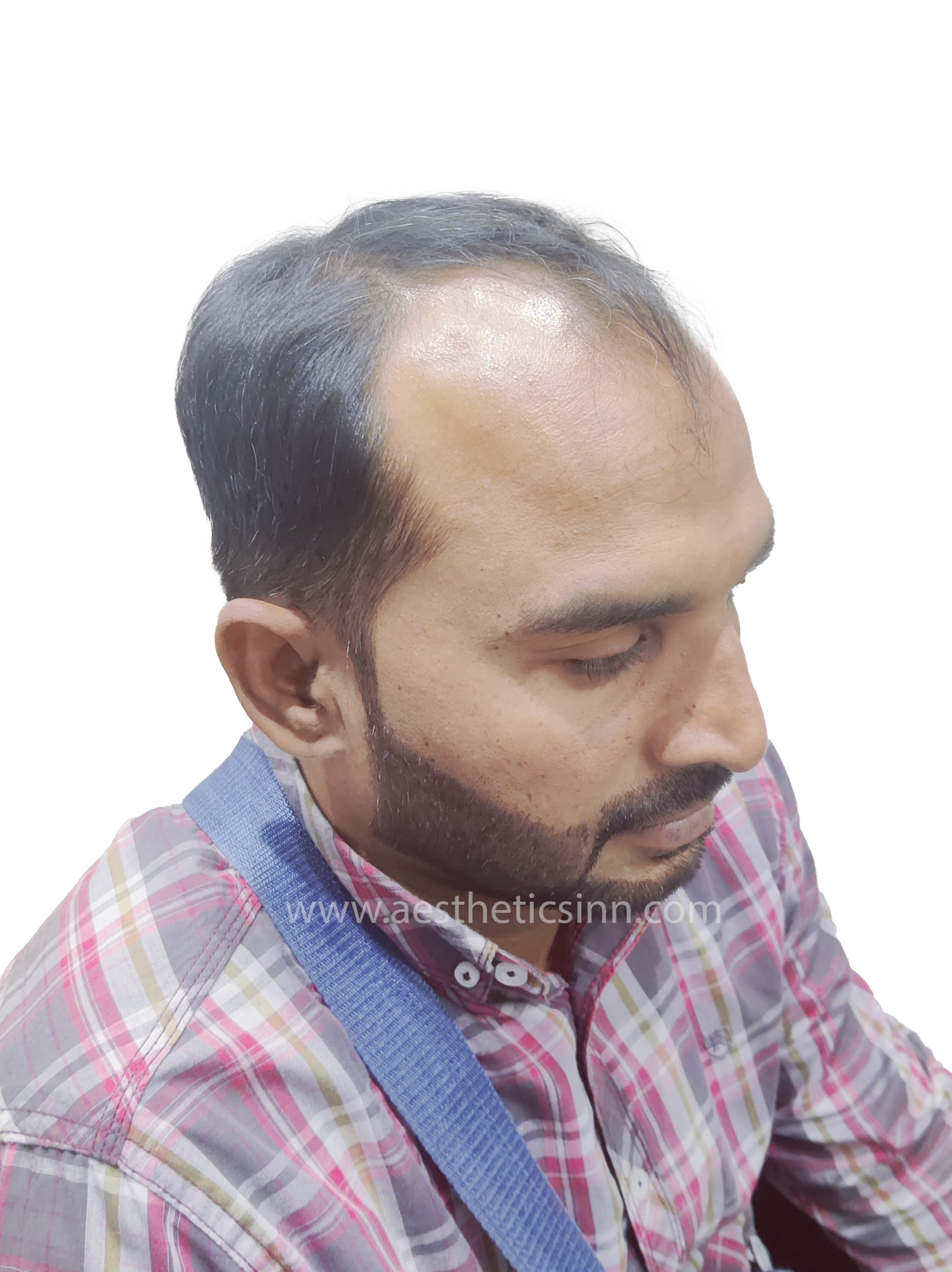 Mujahid Azeem Left Temple Before