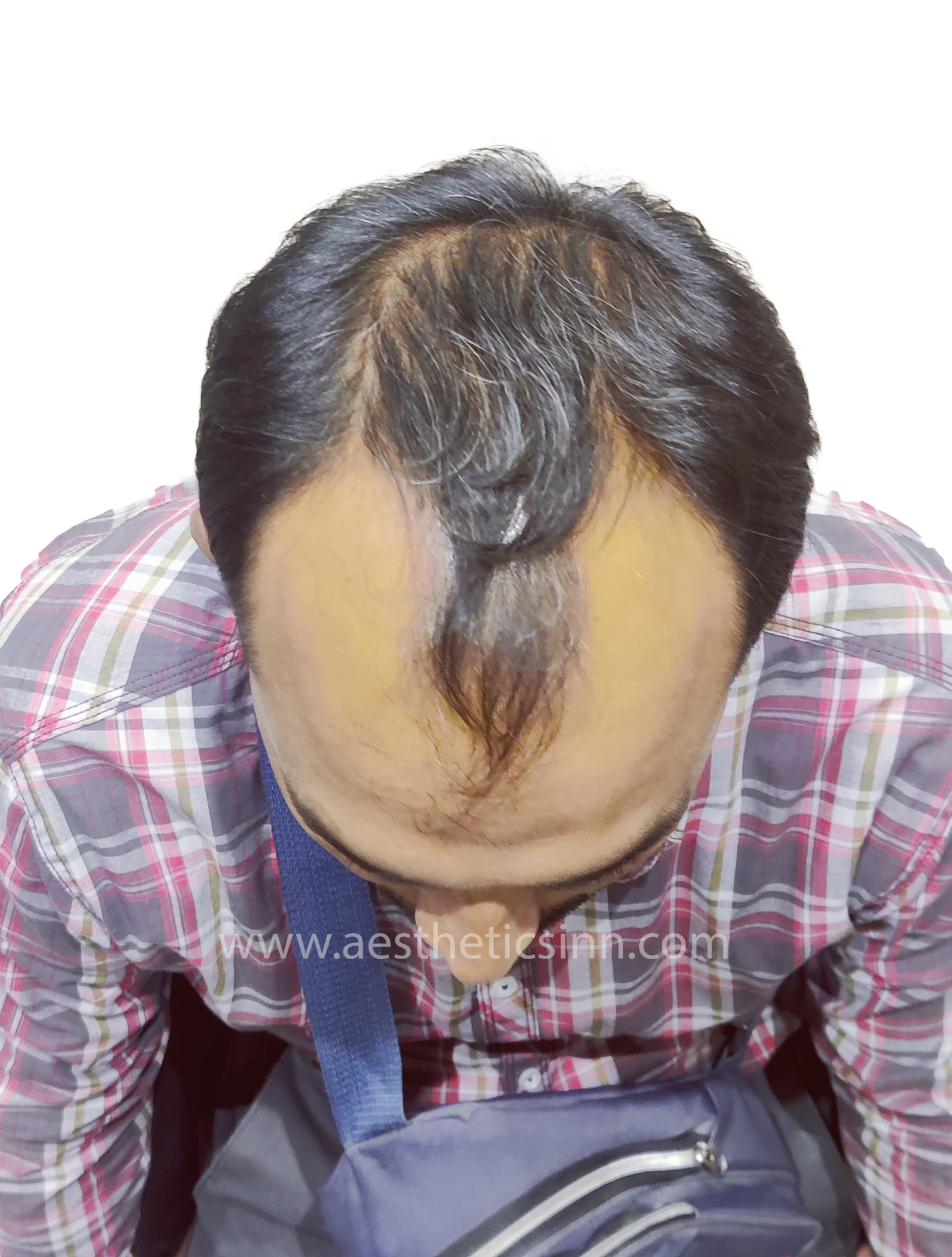 Mujahid Azeem Top View Before