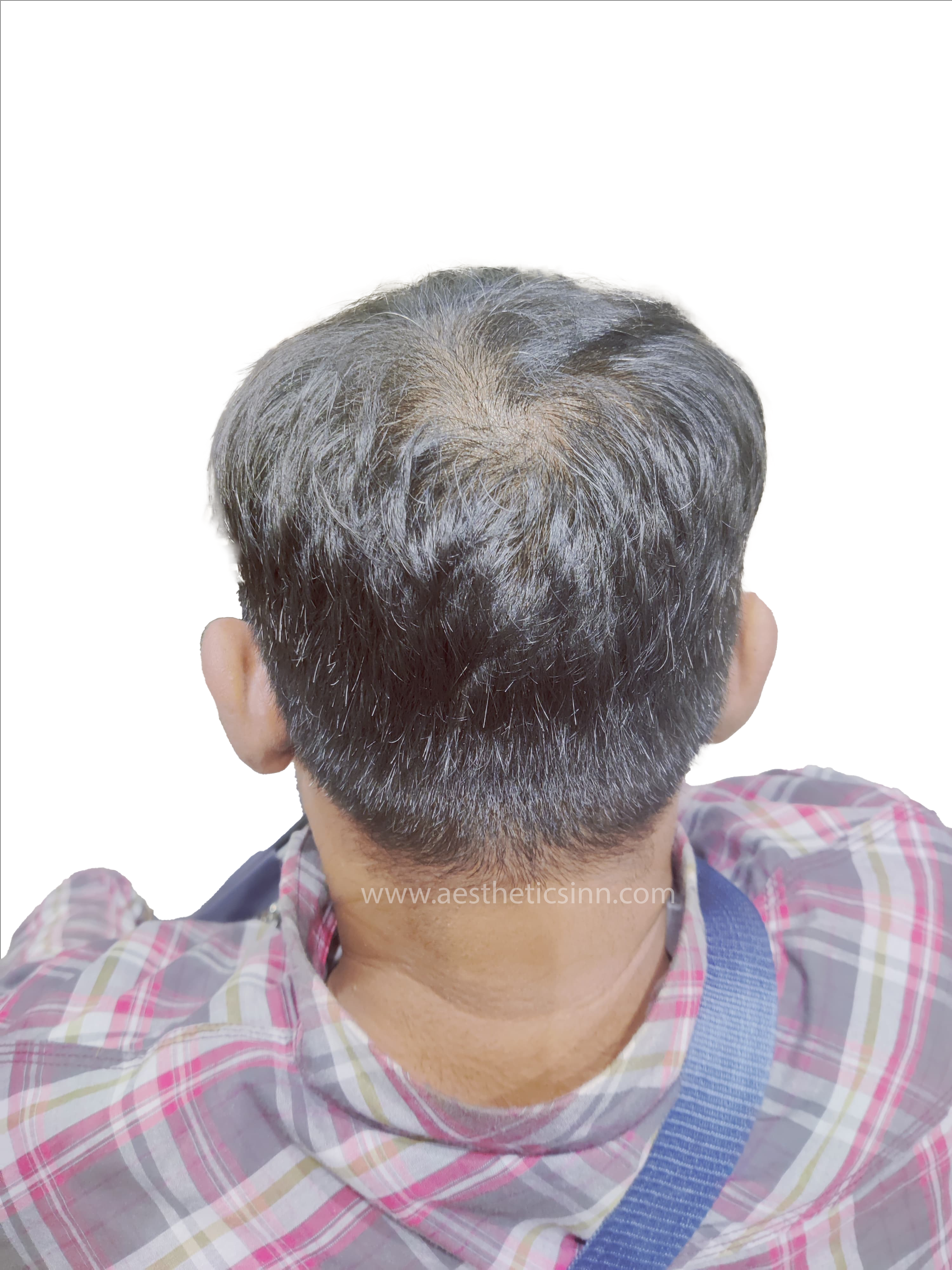 Mujahid Azeem Macro View Before