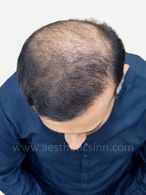Rashid Habib Top View After