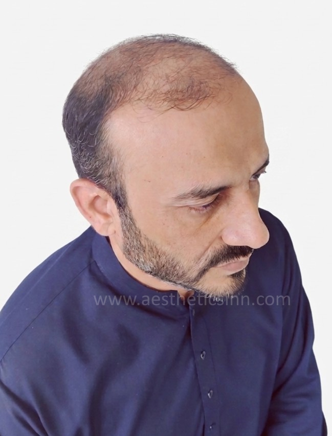 Rashid Habib Left Temple Before